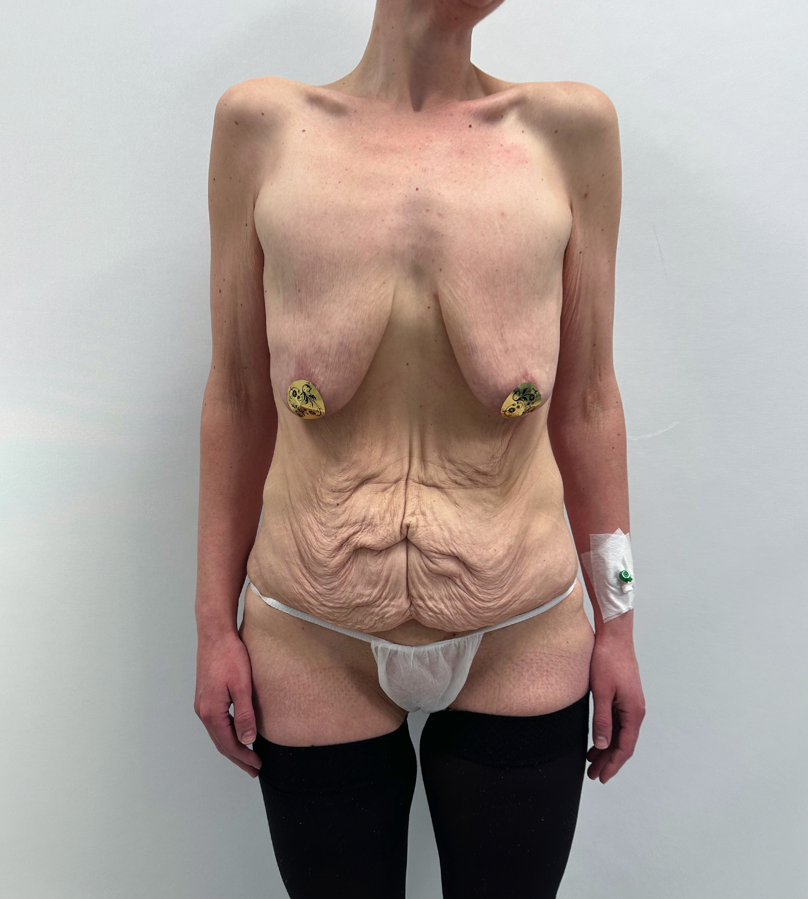 До