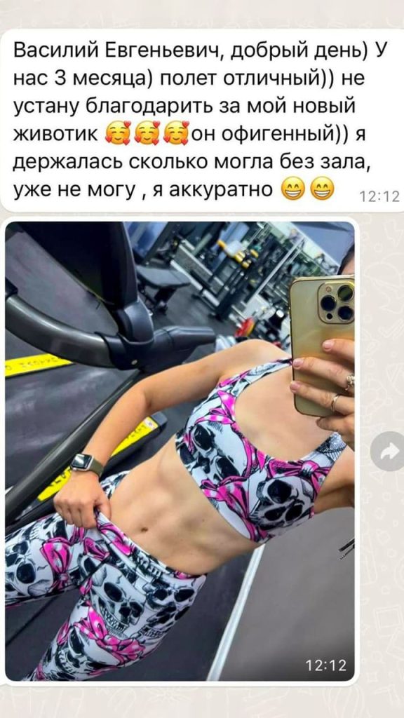 Отзыв после ушивания диастаза с рубцами и растяжками. Никитин В.Е.
