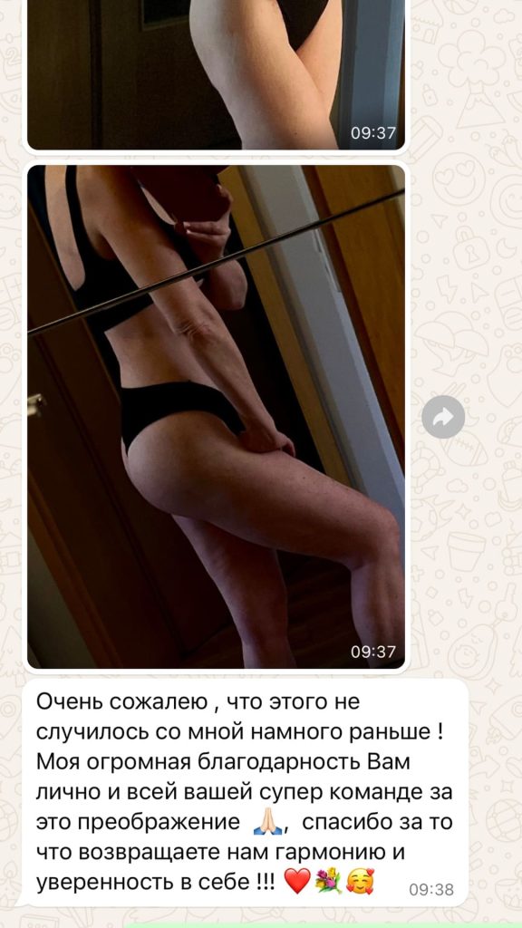 Бодилифт, липосакция и липофилинг ягодиц. Фото отзыва. Хирург Никитин
